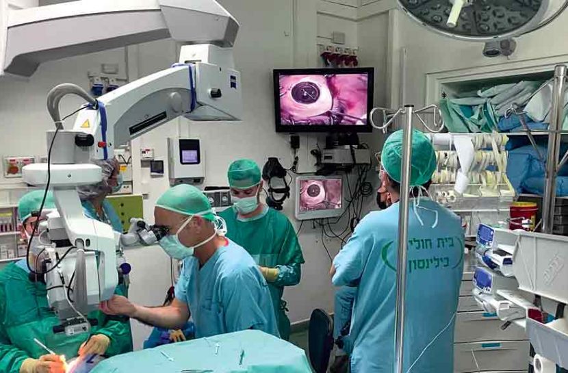 Foto de quatro pessoas em uma sala de cirurgia durante o transplante de córnea